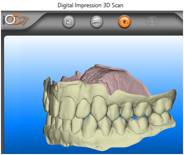 3D Scan